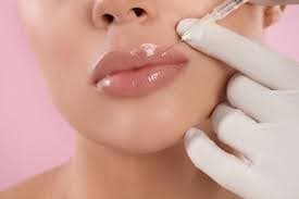 Tratamiento Labial con Ácido Hialurónico